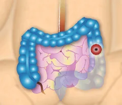 fioletowo-biały obiekt