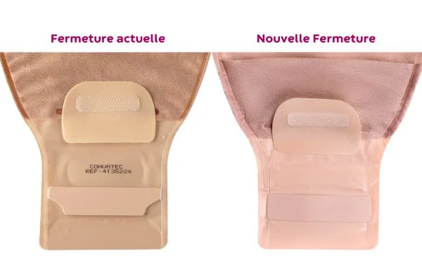 Nouvelle fermeture InvisiClose avant et après