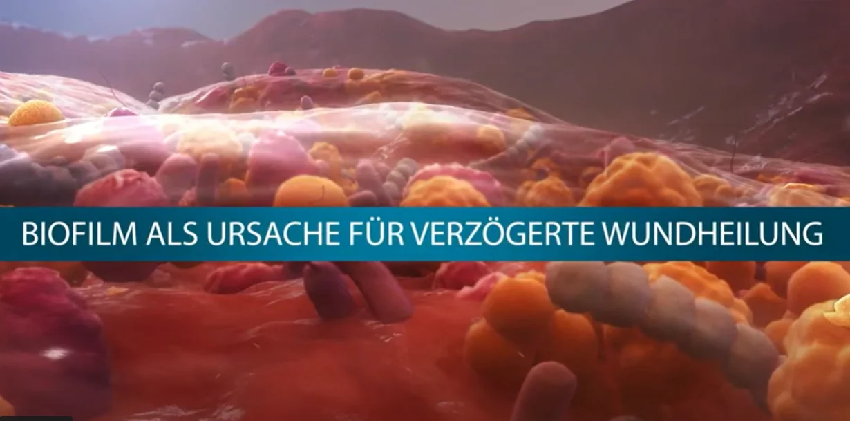 Grafische Darstellung eines Biofilms als Vorschaubild für das Erklärvideo. 