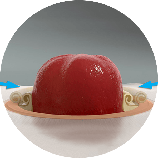 illustration of a skin barrier